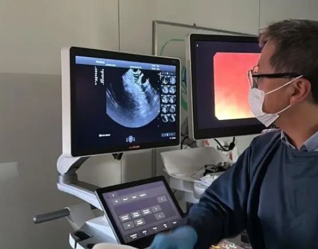 Innovative Medical Diagnostic Tools: A Breakthrough Path for Color Doppler Ultrasound Manufacturers